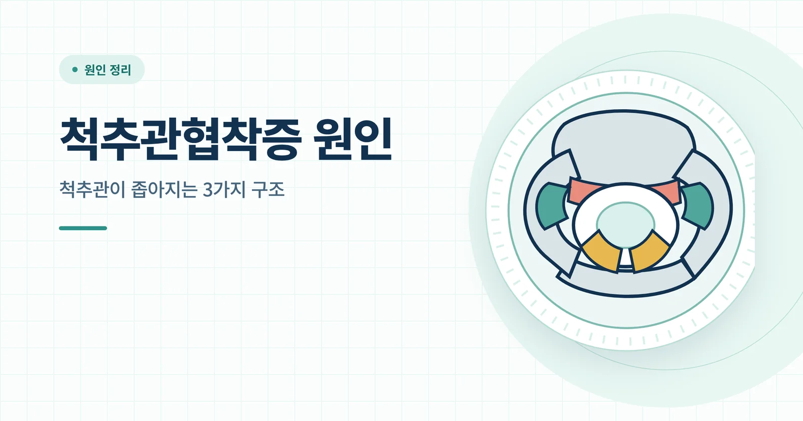 척추관협착증 원인